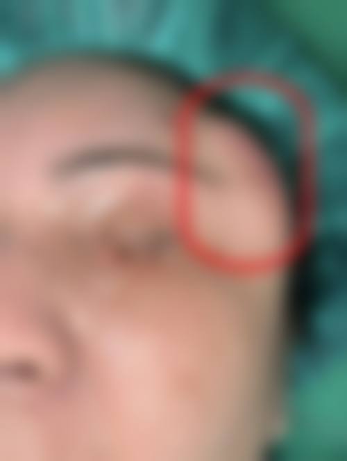 七、芜湖一秒整形医院价格表：（仅供参考）