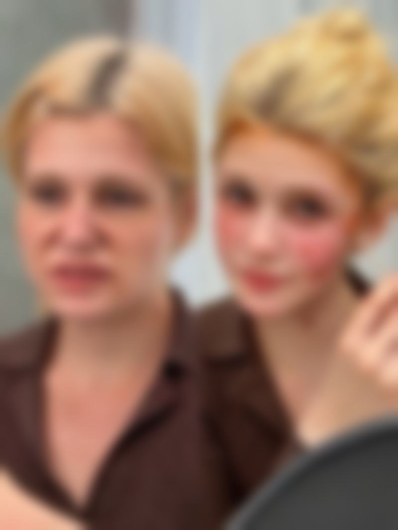 隆鼻成效持久度大比拼：线提升隆鼻的保鲜期