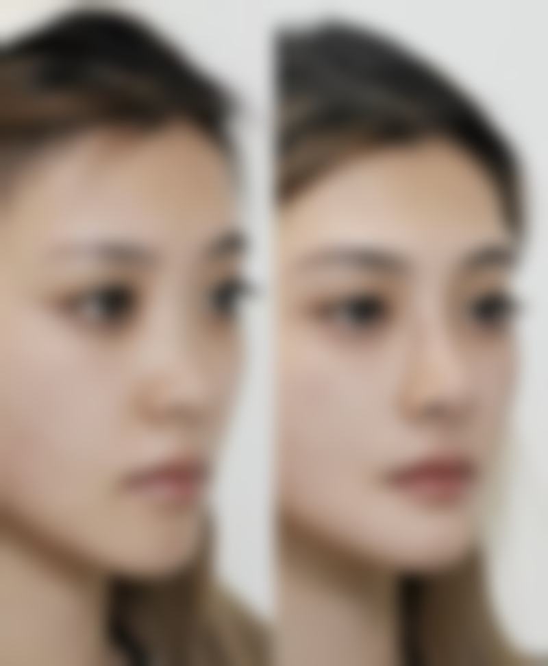 七、滨州东方美整形医院价格表：（仅供参考）