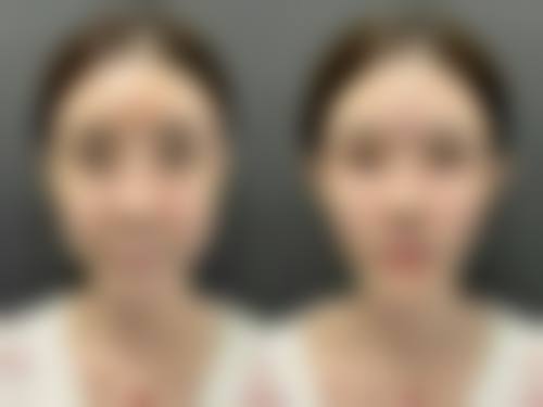 帅楠眼袋贴：使用体验良好，副作用概率小