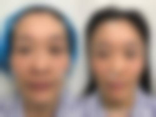 七、西昌菲德医疗美容门诊部真实的顾客评价如下：