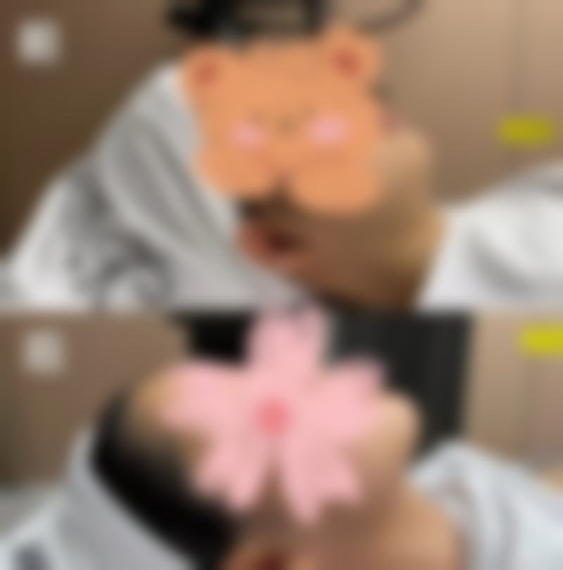 傲诺拉隆胸假体好不好使?产品系列特别丰富