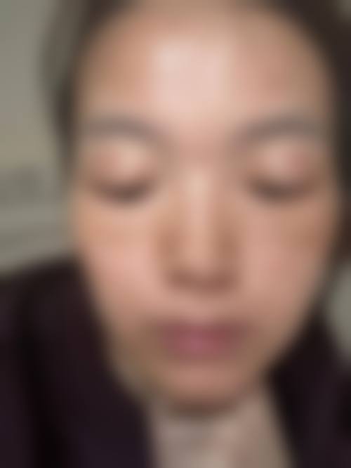八、莱州市慢性病防治院医疗美容中 心真实的顾客评价如下: