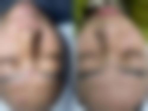 七、重庆简熙(好美新妍)医疗美容门诊部价格表：（仅供参考）