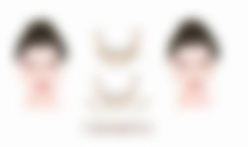 还你明亮双眸！改善双眼皮下垂的手术治疗法