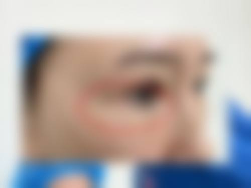 六、乌鲁木齐王焕梅整形医院怎么预约: