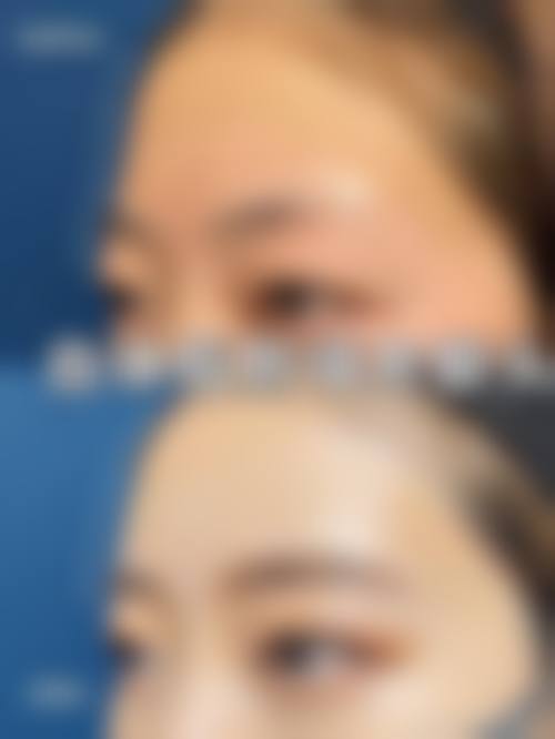 七、成都瑛爱整形医院价格表:(仅供参考)