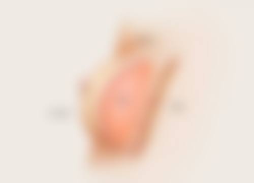 增生疤痕疙瘩该挂哪个科室?不同来源的专精建议