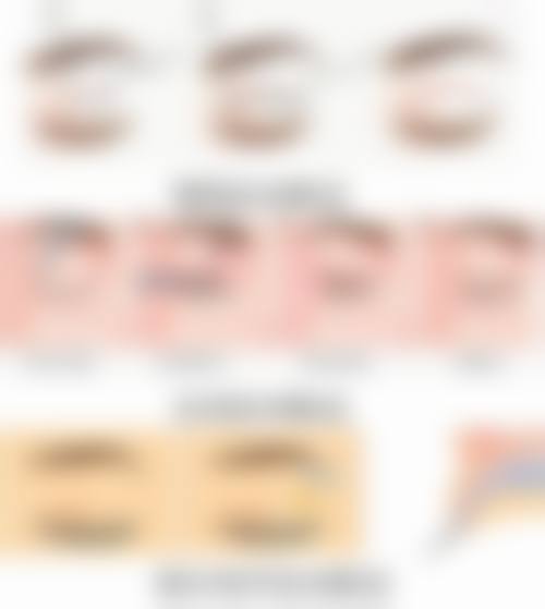抽脂抽出的脂肪,有哪些合规处理方式?