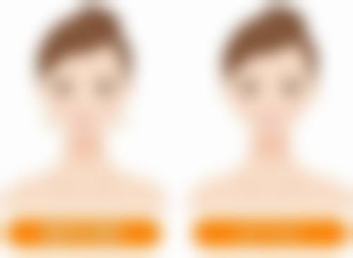 增生疤痕疙瘩该挂哪个科室?选对科室的好处