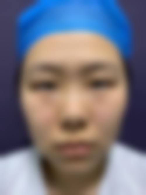 八、宜兴洵美会整形医院真实的顾客评价如下:
