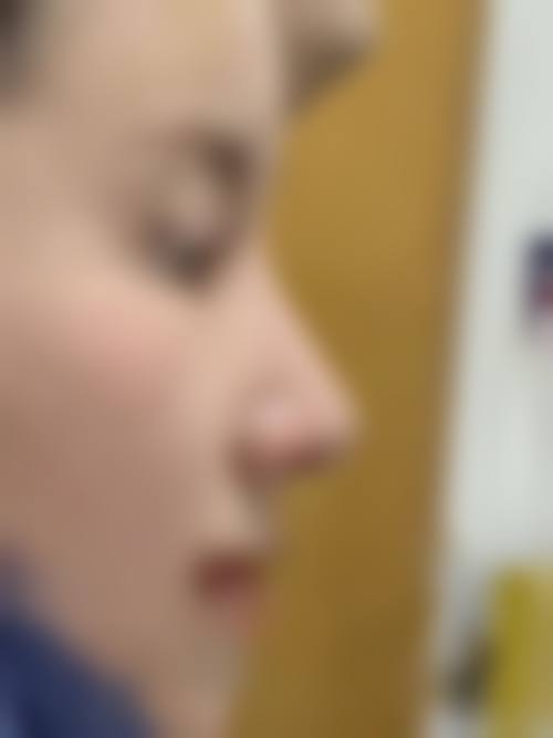 七、连云港维多利亚整形真实的顾客评价如下:
