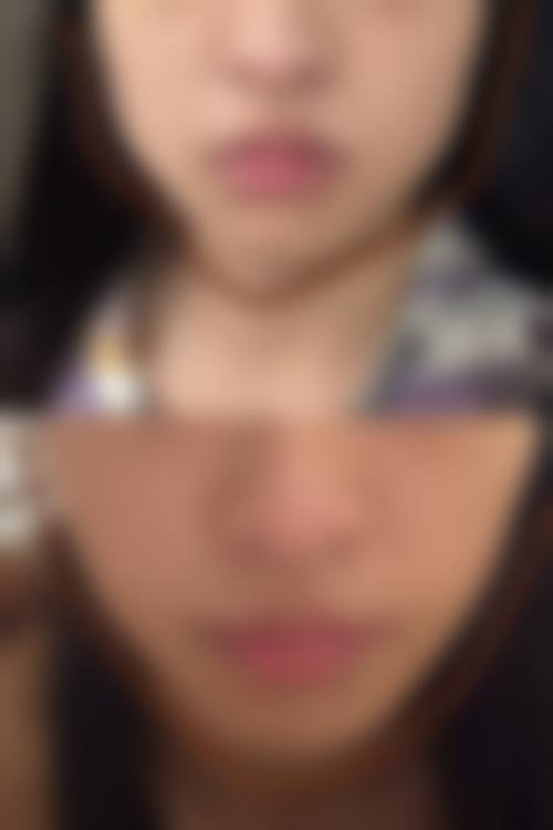 五、成都简娜华美医疗美容诊所实例