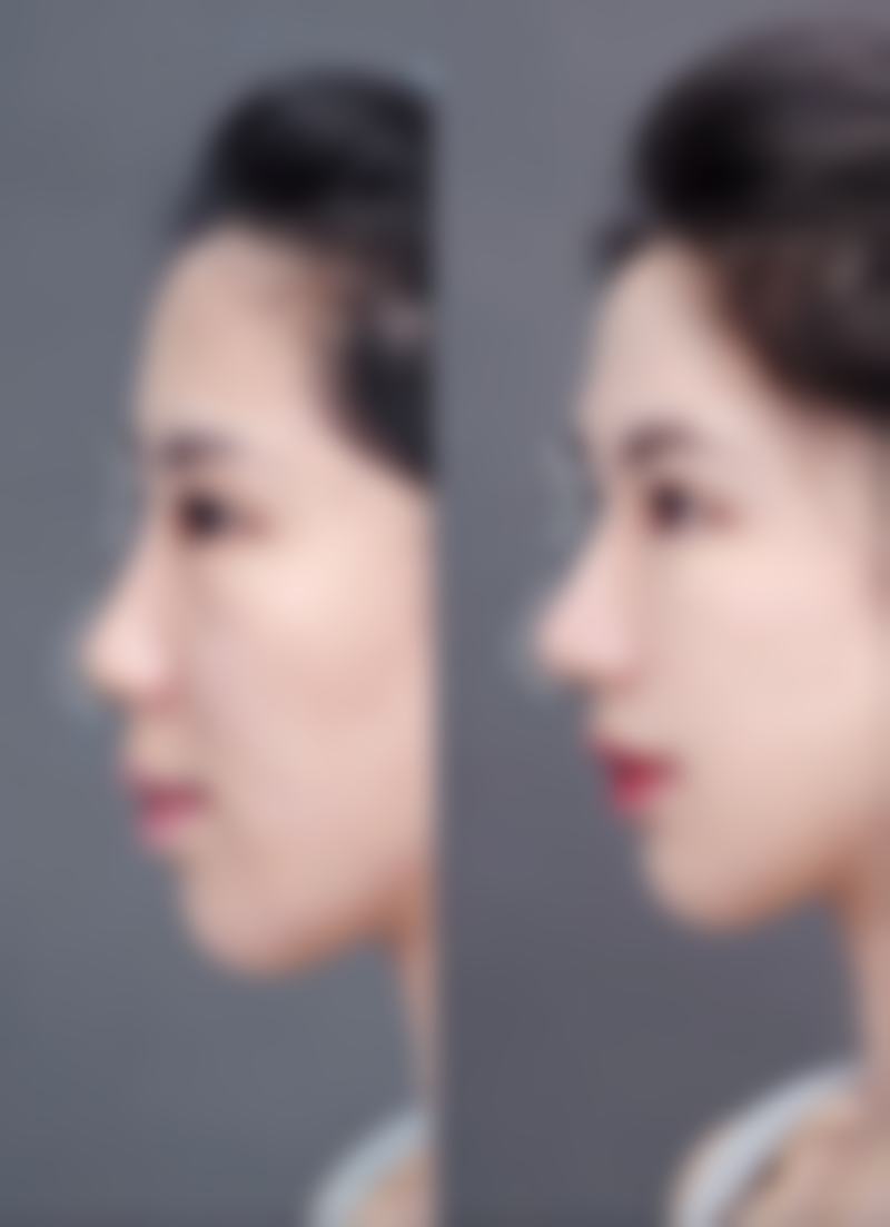 朴濬医生怎么样可靠吗?