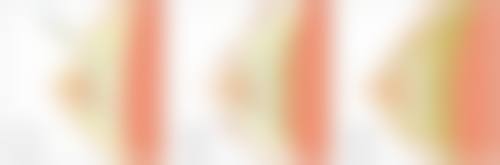 哪种隆胸方式更安心?IBA玻尿酸注射隆胸的便捷之选