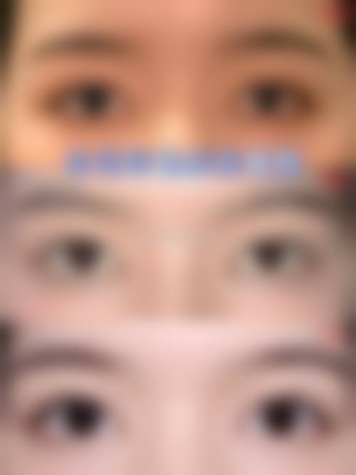 五、内蒙古佳丽整形医疗美容诊所实例