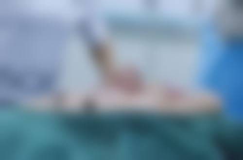 四、厦门爱搜美莱整形医院实例