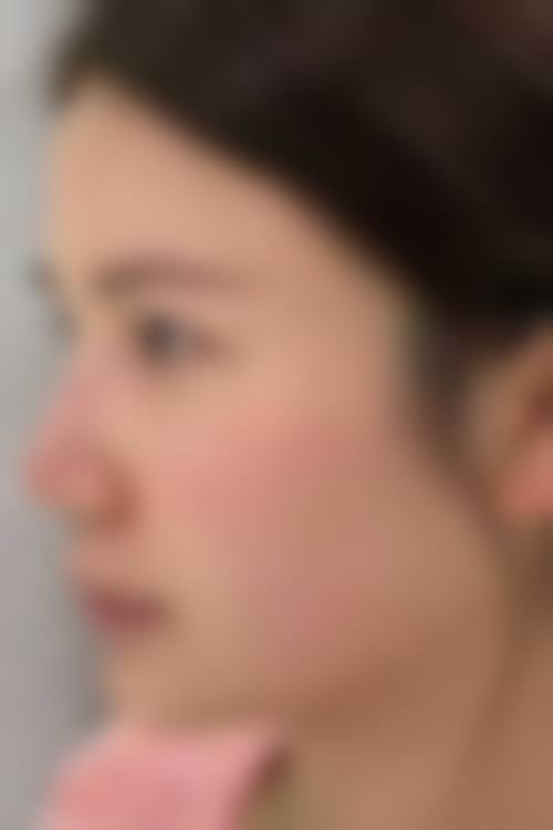 七、韩国BEST整形外科医院价格表:(仅供参考)