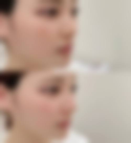 五、韩国BEST整形外科医院实例