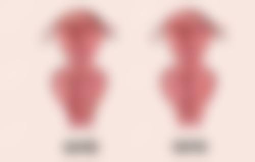 全切双眼皮15天出现增生咋办？掌握这些应对妙招，有效缓解增生问题 