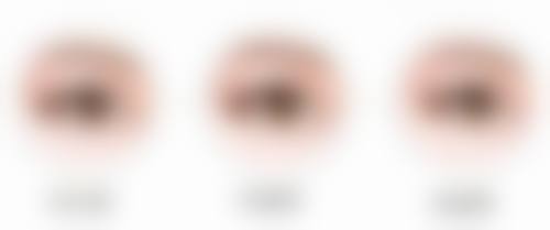 割双眼皮修复时间:术后护理特别关键