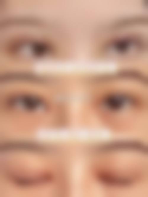 七、沈阳皇姑高丽芬医疗美容诊所价格表:(仅供参考)