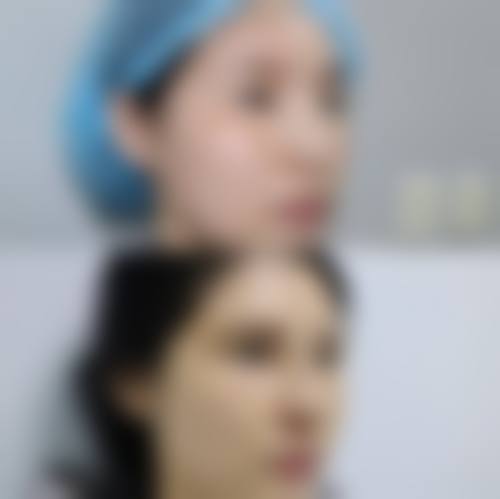 五、临汾现代整形医院实例