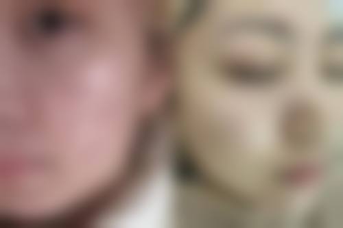 蒋正华医生实例