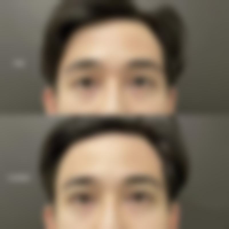 五、惠州今喜整形医院实例