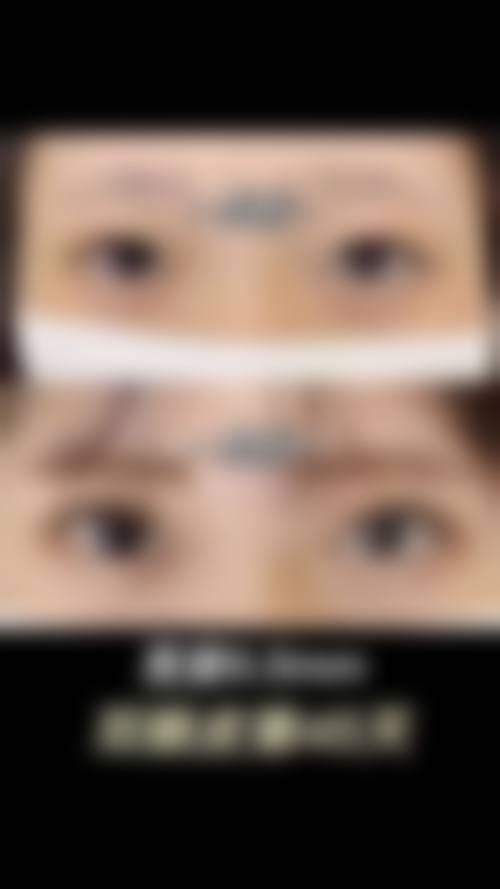 七、北京美奥诊所价格表:(仅供参考)