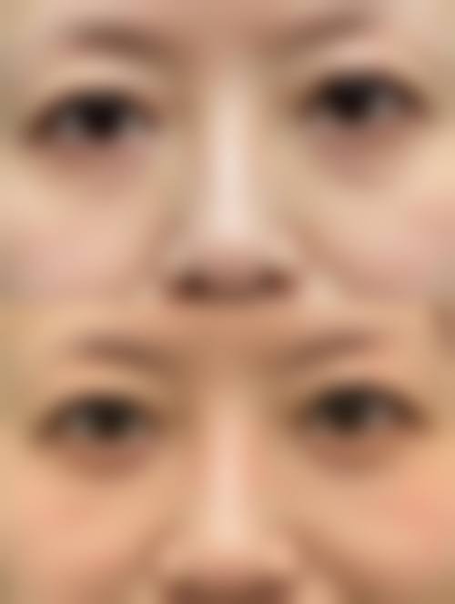 六、神木天阙医疗美容诊所价格表：（仅供参考）