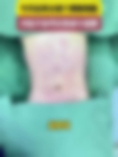 五、东莞百佳医疗美容(原玛利亚)实例