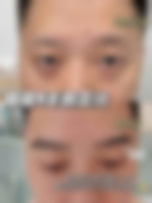 七、南京建国领秀植发价格表:(仅供参考)