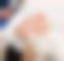 五、韩国釜山丽婷整形外科实例