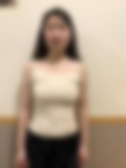 五、武汉艺美整形医院实例