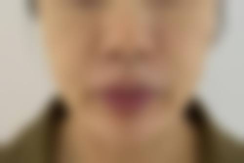 八、上海诠韩医疗美容医院真实的顾客评价如下：
