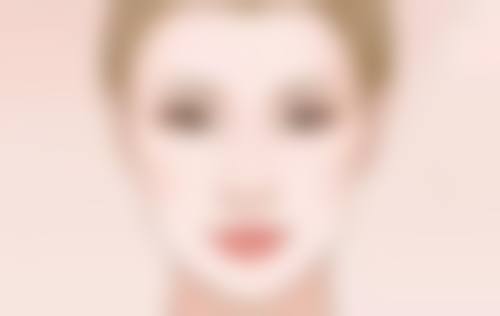 割双眼皮后期有啥副作用?形态不佳、上睑下垂需关注