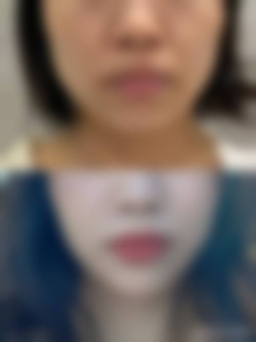五、青岛佳芙美医疗美容诊所怎么预约:
