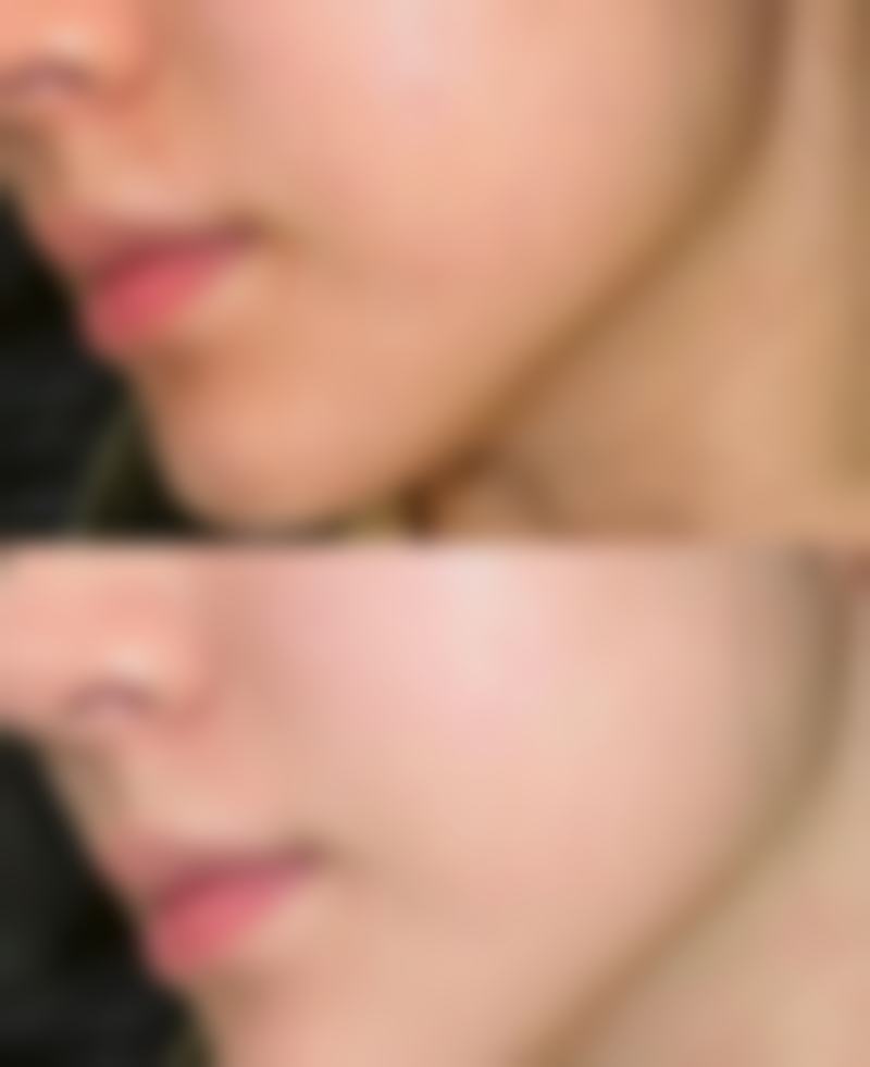 八、锦州锦美整形医院真实的顾客评价如下: