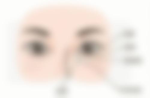 骨粉隆鼻:至佳取出时机特别重要