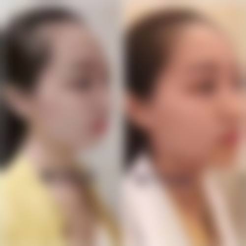 吴瑞星医生口碑和评价