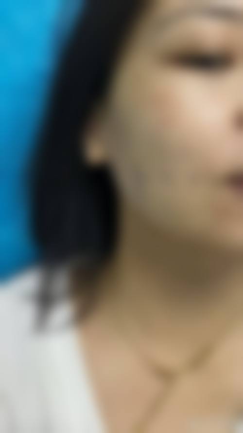 四、宿迁沭阳县微悦医疗美容门诊部实例