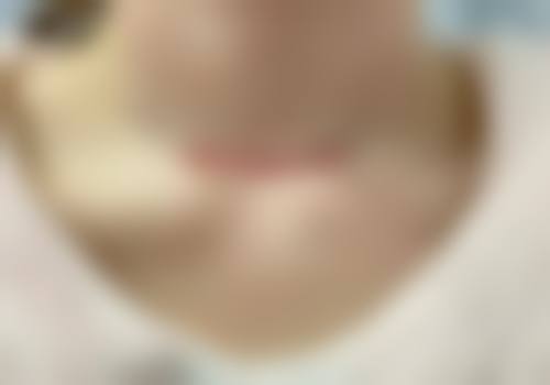 七、淮安星璨医疗美容诊所价格表:(仅供参考)