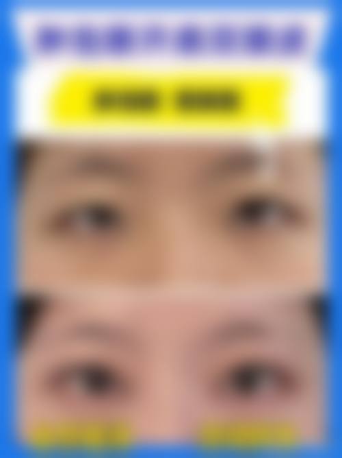 五、杭州新风阅美整形医院怎么预约: