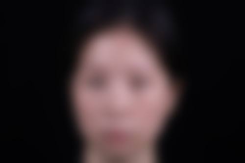 六、杭州新风阅美整形医院价格表:(仅供参考)