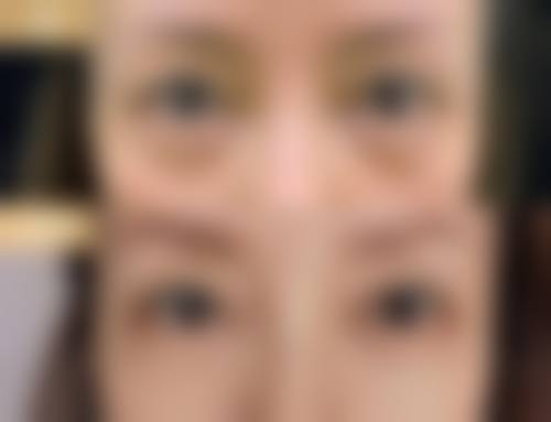 五、武汉贺莹中医美容诊所实例