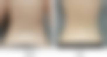 刘学军医生项目价格表参考