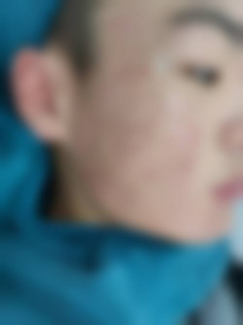 三、山东第一医 科 大学附属皮肤病医院（激光美容外科）医生介绍