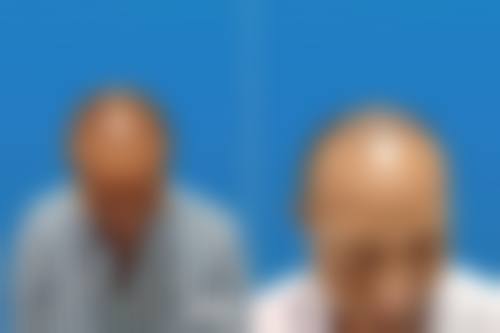三、长沙禧朵植发医院医生介绍: