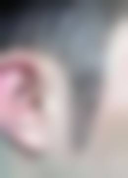 八、长沙禧朵植发医院真实的顾客评价如下：